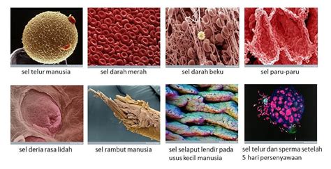 Namun, pada sistem otot manusia, mekanisme kerja otot polos ini dikendalikan oleh sistem saraf otomatis. Kehidupan yang indah pun bermula..........: Kanser ...