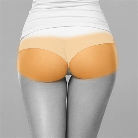 You can remove hair from the buttocks in many of the same ways you remove hair from other areas, but it requires more caution. Buttocks - Laser Hair Removal NYC