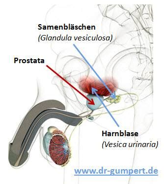 Aber auch innere organe könnten laut der studienautoren betroffen sein, sodass es zu erweiterungen von blutgefäßen im gehirn komme, was zu kopfschmerzen, aber auch panikreaktionen und. Prostata