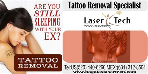 These older methods, however, have been nearly completely replaced by laser removal treatment options. Relax and Rejuvenate at LaserTech MedSpa in Nogales, Mexico