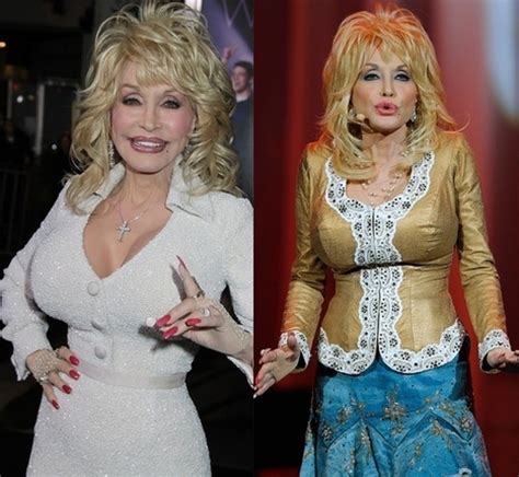 Few things bring folks together like the music of dolly parton. Celebrity Plastic Surgery | Scoop.it