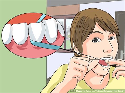 Baking soda is alkaline and it can help to remove plaque and white spots. 3 Ways to Remove Yellow Between the Teeth - wikiHow