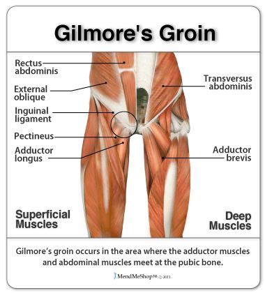 Hip adductor muscles together make up the groin area. 152 best images about Hip & Thigh Pain Relief on Pinterest ...