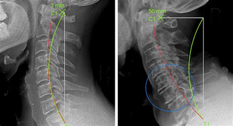 Check spelling or type a new query. Correction posturale • La Vie Chiropratique - Clinique ...