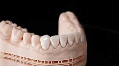 Veneers Teeth On Jaw Model Shot Stock Footage Video (100% Royalty-free) 1105398869 | Shutterstock
