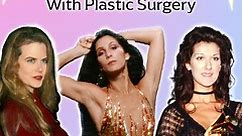 Celebrities Before & After Plastic Surgery
