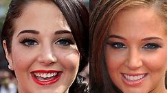 Celebrity Teeth: Before And After
