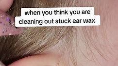 Satisfying Ear Cleaning: Removing Stuck Ear Wax | Ear Cleaning Videos