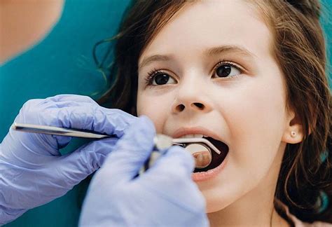 Dokter gigi spesialis anak di Buah Batu Bandung